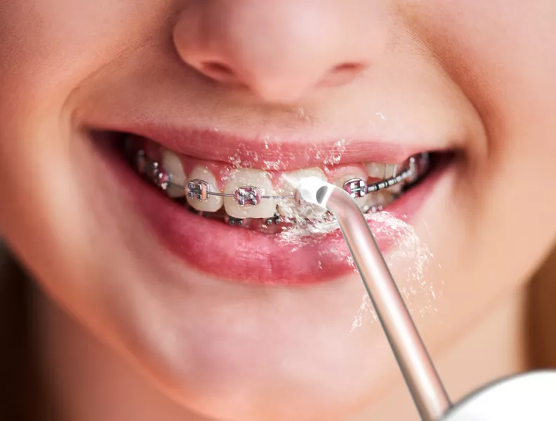 Perfecto para la limpieza de brackets