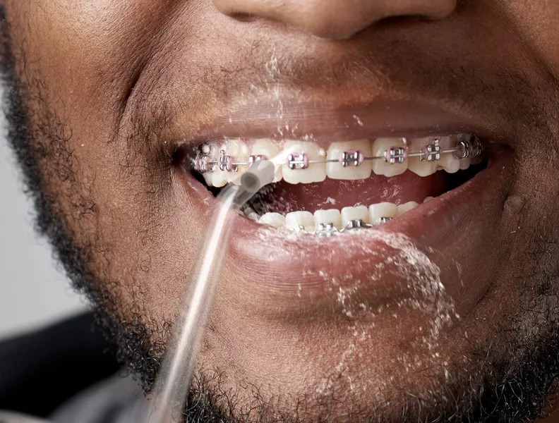 Perfecto para la limpieza de brackets