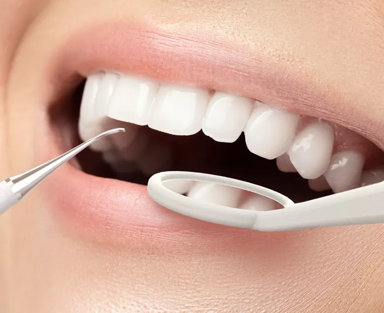 Profesionalno uklanjanje plaka